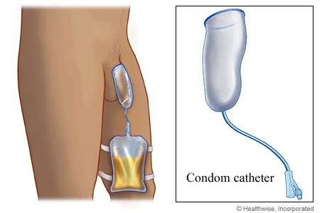 Condom Catheters