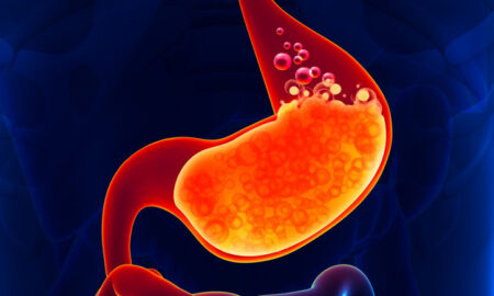 Digestive Enzymes With Hydrochloric Acid: Boost Your Gut Health