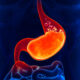 Digestive Enzymes With Hydrochloric Acid: Boost Your Gut Health